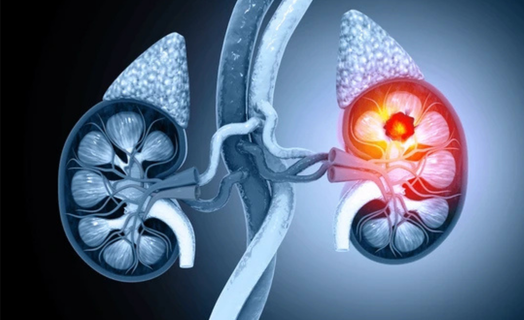 Patología molecular de los tumores urológicos